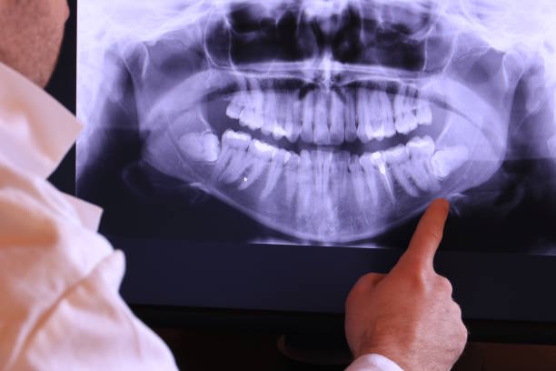 Best Emergency Dental Care for Abscessed Tooth in West Odessa, TX