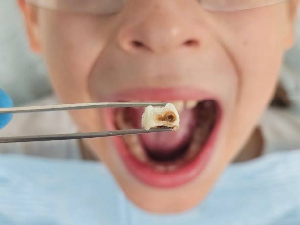Best Broken or Cracked Tooth Emergency Dentist in West Odessa, TX