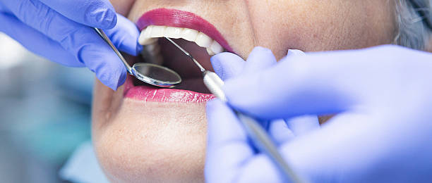Best Emergency Dentist for Knocked-Out Tooth in West Odessa, TX